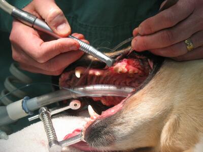 Dental Cleaning